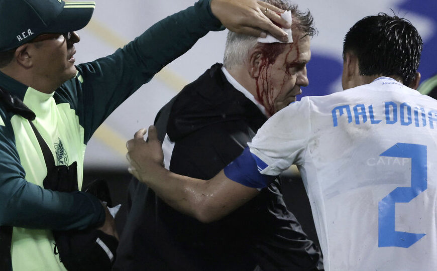 Violencia en el fútbol: Javier Aguirre resultó herido…