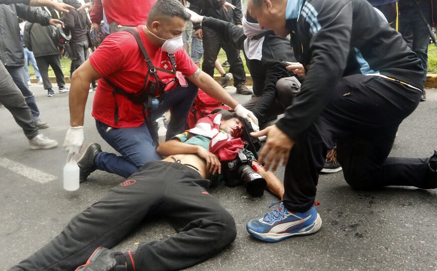 Gendarmería culpó a Pablo Grillo de ubicarse “en la línea de tiro” | Un informe exprés responsabilizó al fotoperiodista por el disparo que casi lo mata